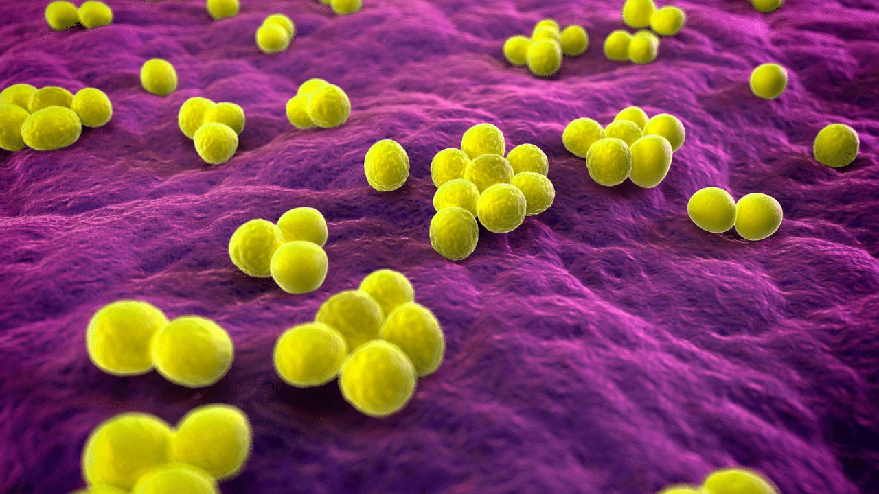 Stafilokokne infekcije