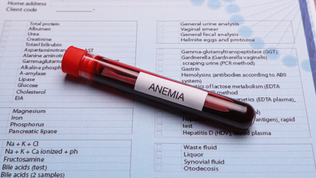 anemija srpastih stanica