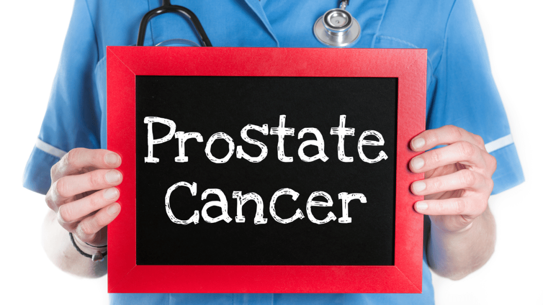 Rak prostate