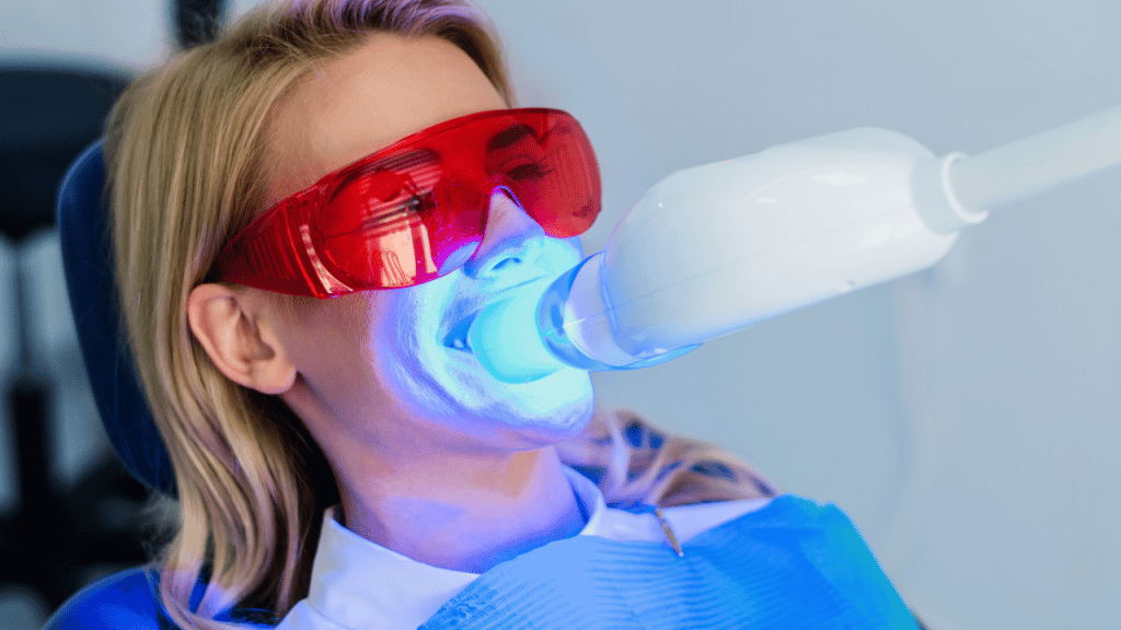 Metode izbjeljivanja zubi