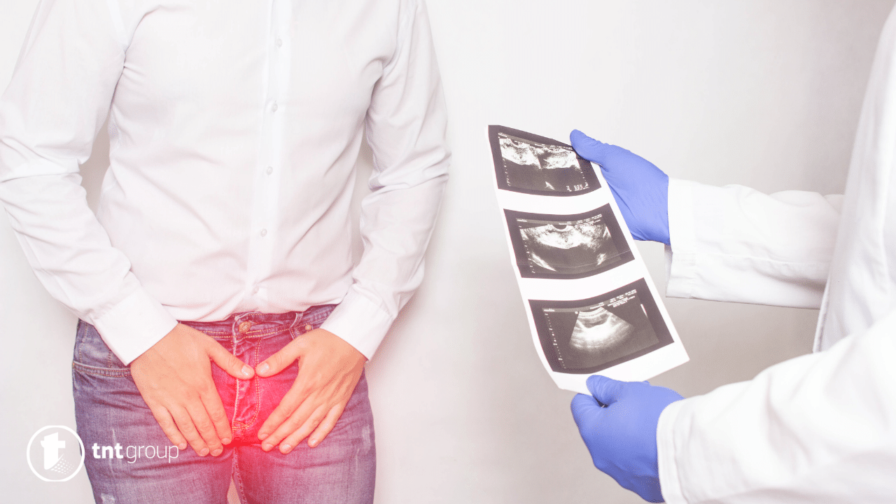 Kako se koristi čaj za prostatu u terapiji: Saveti i preporuke