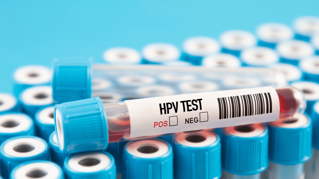 Kako izbaciti HPV virus iz organizma